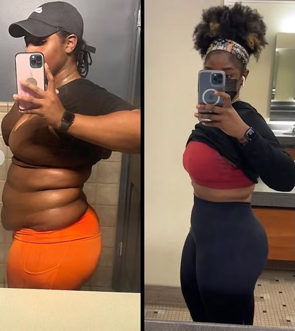Antes e depois de mulher com barriga desinchando em poucas semanas